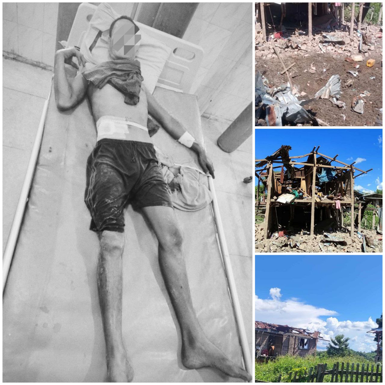 သီပေါမြို့နယ်၊ ဘော်ကြိုကျေးရွာကို စစ်တပ်က လေကြောင်းဖြင့် ဗုံးကြဲတိုက်ခိုက်မှု ပြည်သူ ၁ ဦး ဒဏ်ရာရပြီး နေအိမ် ၃ လုံးပျက်စီး